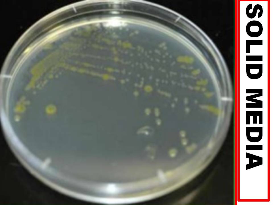 этапы выделения чистой культуры микробов. как называется чистая культура микроорганизмов. микробы в чашке петри. чистая культура.