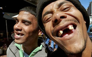 dientes feos humor