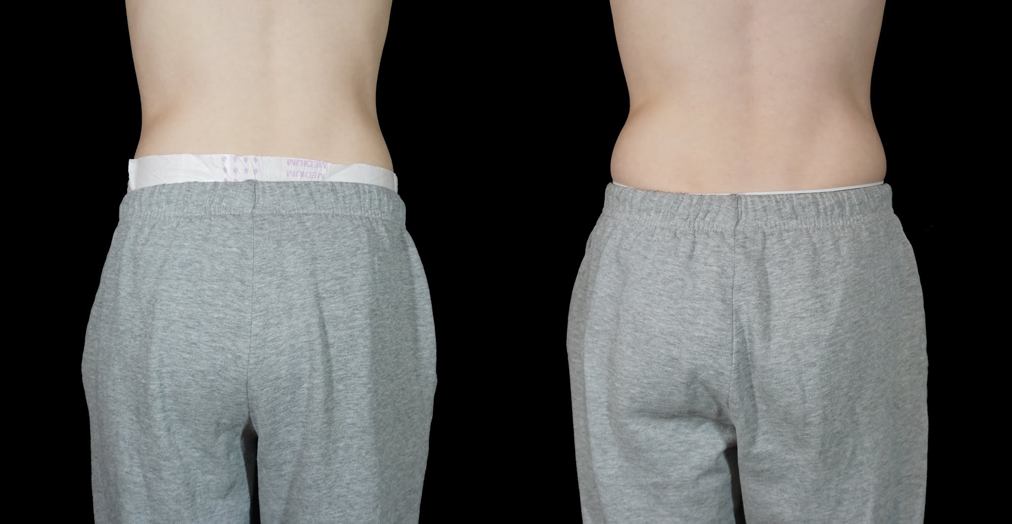 Diaper Metrics Medline Extended Wear Adult Diaper Review