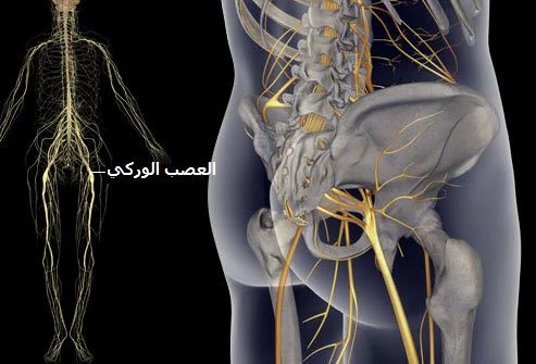 التهاب عرق النسا| أسباب، أعراض، مضاعفات، أحدث علاج ووقاية