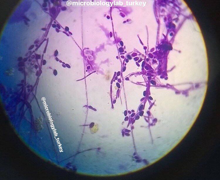 Молочница гриб. Грибы кандида микроскопия. Кандида альбиканс мазок. Кандида альбиканс под микроскопом. Псевдомицелий кандида.