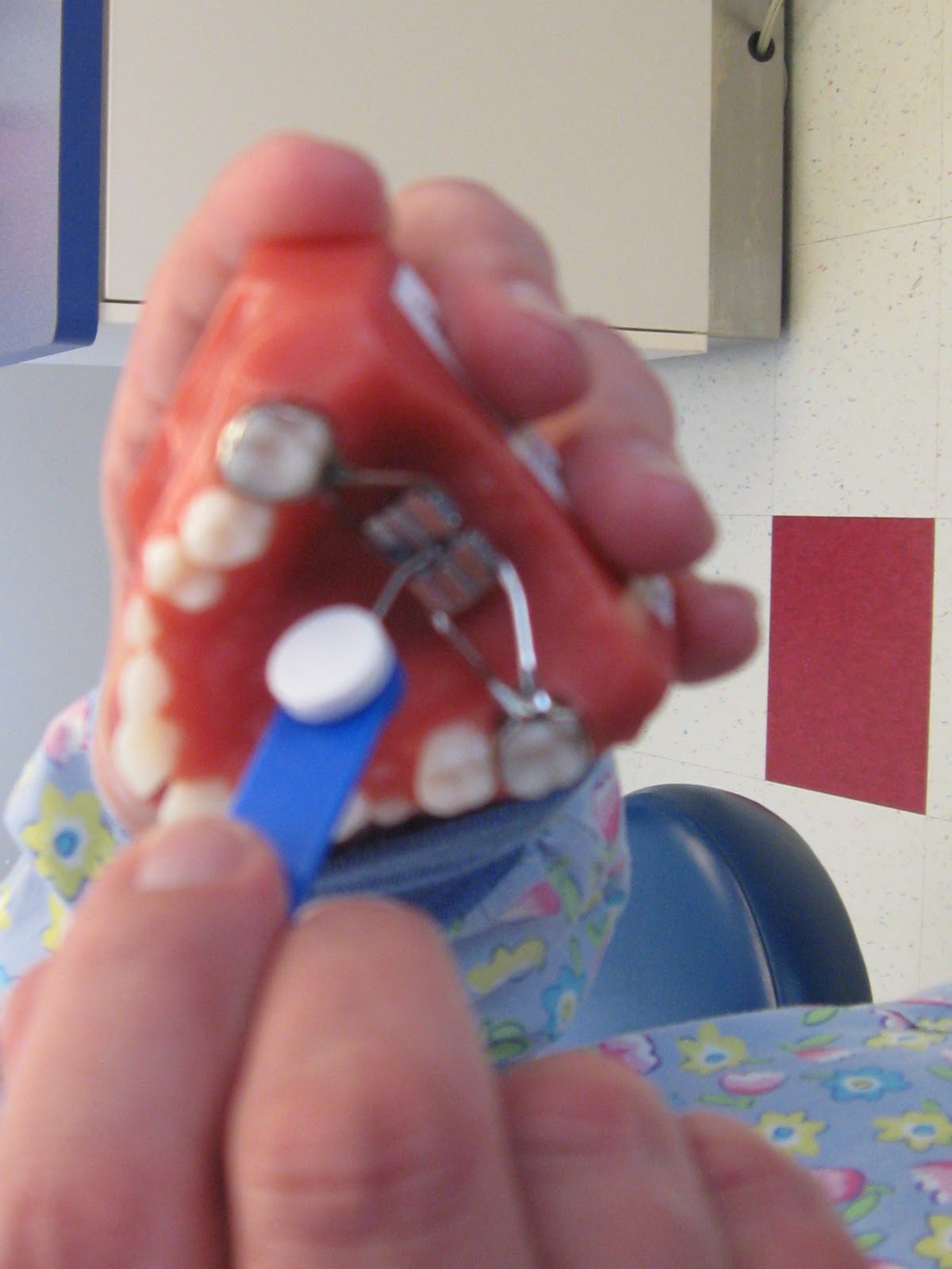 The Never Ending Adventures of Colin and His Palate Expander! Back to