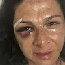 Cuatro facinerosos golpean a la senadora Ana Gabriela Guevara