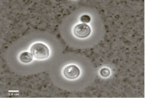 Cryptococcus gattii