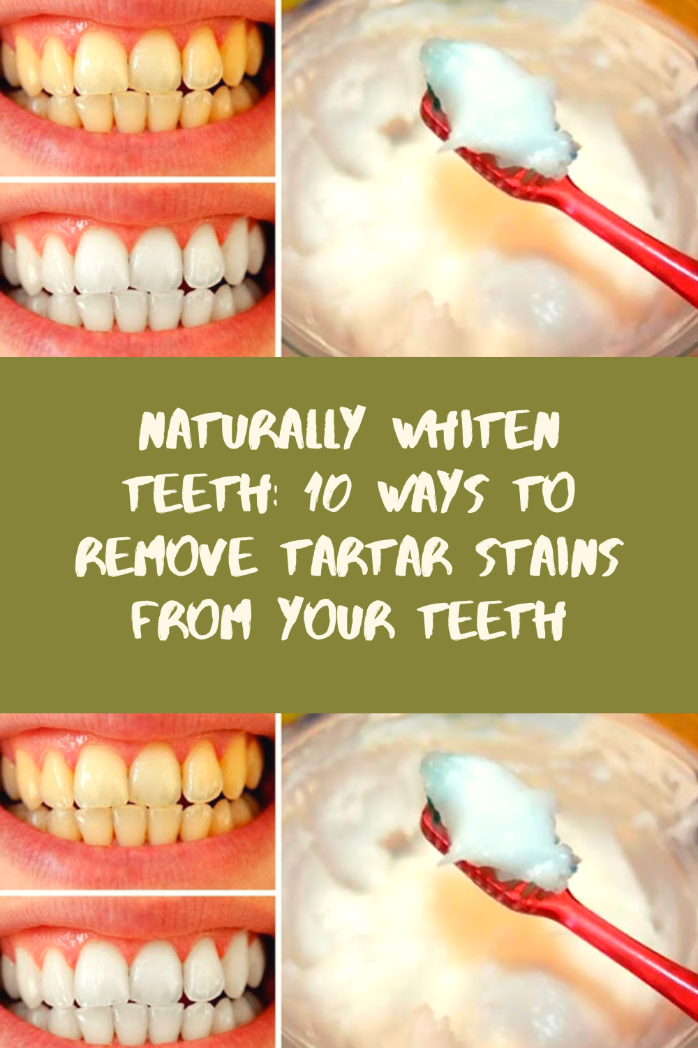 Naturally Whiten Teeth 10 Ways To Remove Tartar Stains From Your Teeth