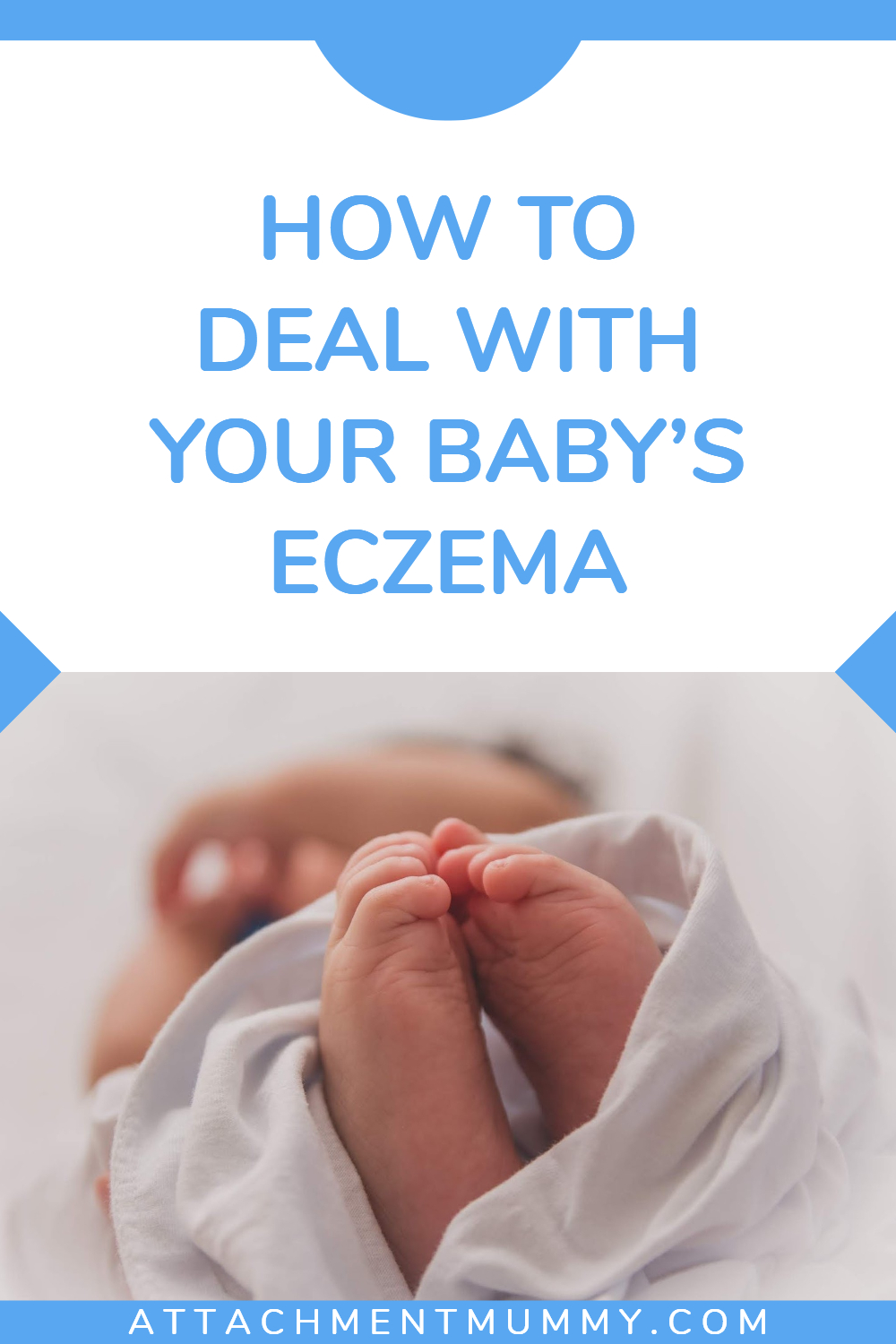 How To Deal With Your Baby’s Eczema