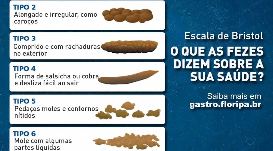 \u0026quot;Saco Mucho\u0026quot;: Os sete tipos de coc\u00f4: o que as fezes dizem sobre a sua ...