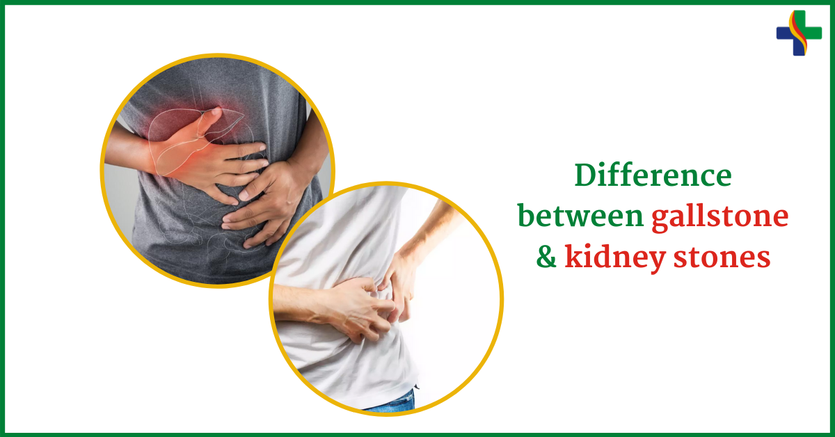 Kidney Stone Or Gall Bladder Stone?