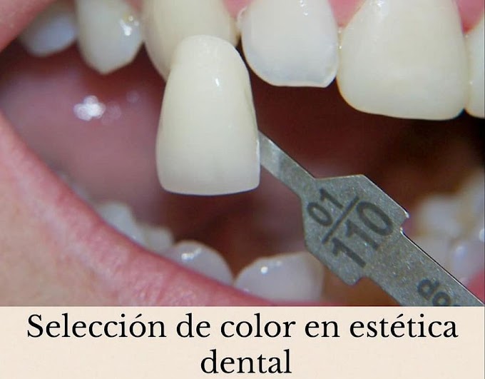 ODONTOLOGÍA RESTAURADORA: Herramientas clínicas para la selección del color - Dr. Jaime Sarmiento Cornejo