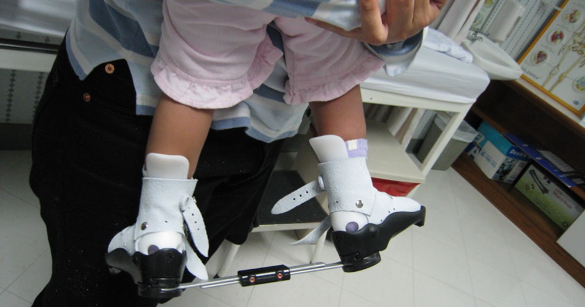 Clubfoot Malaysia Blog - Ponseti for Clubfoot: So why buy from anyone