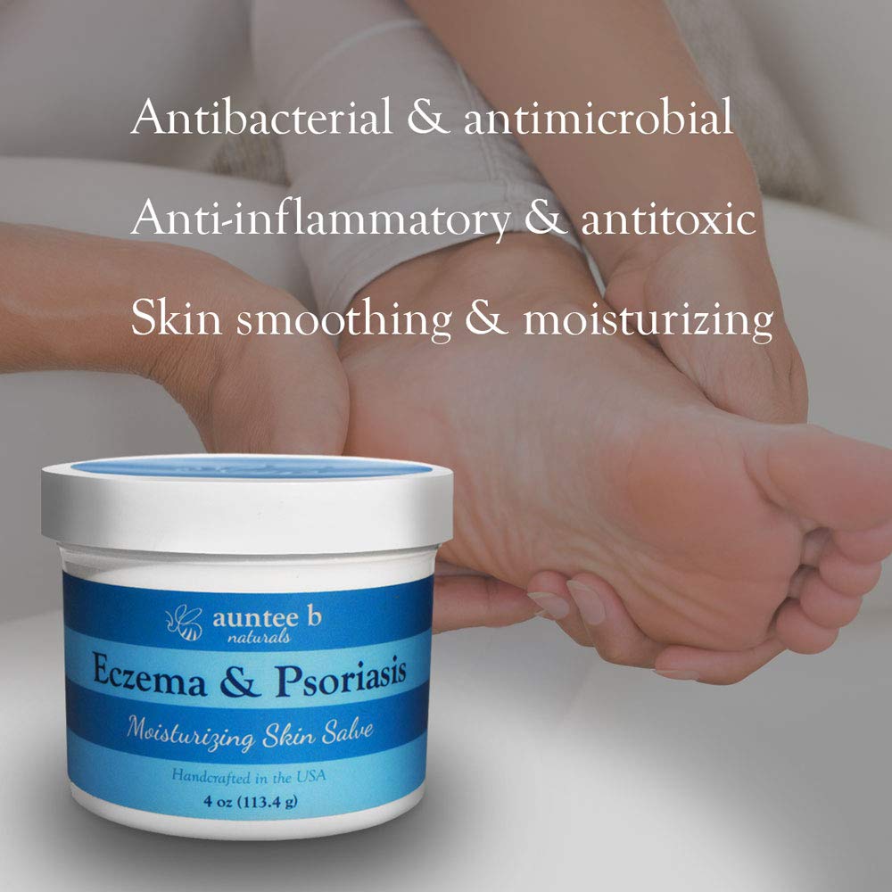 Natural Eczema and Psorisasis Cream