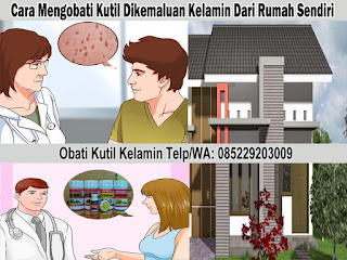 Foto Salep kutil kelamin manjur di apotik kimia farma umum k24