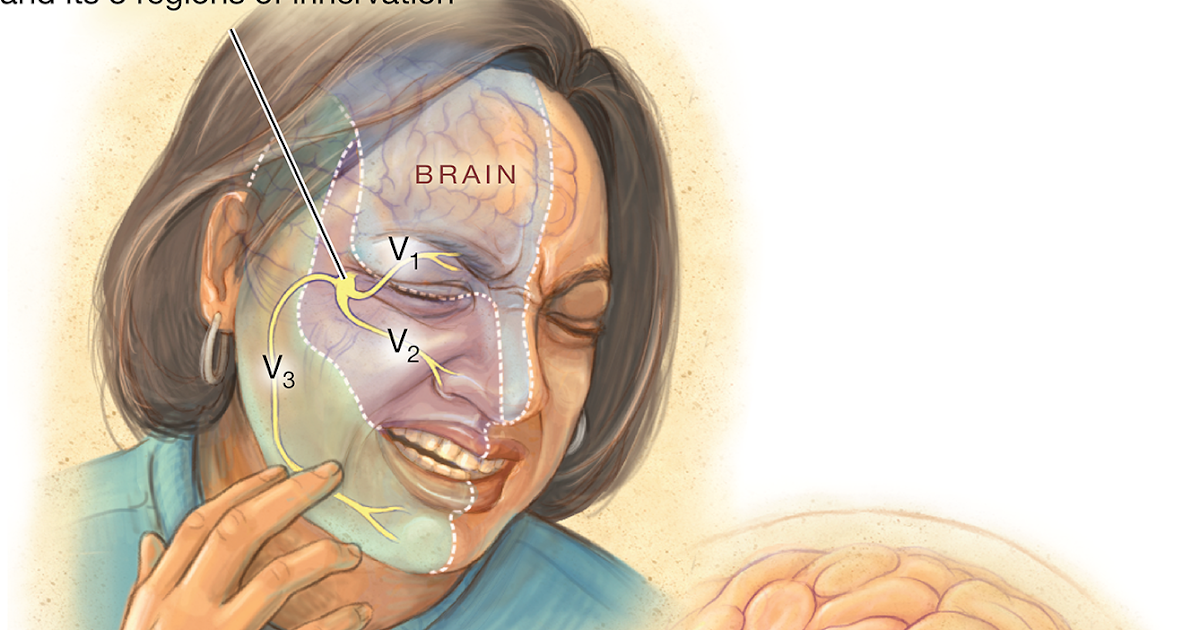 Neuralgia латынь. Neuralgia латынь