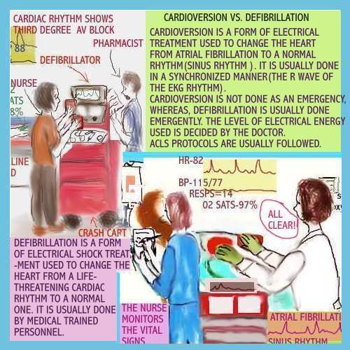 CARDIOVERSION vs DEFIBRILLATION