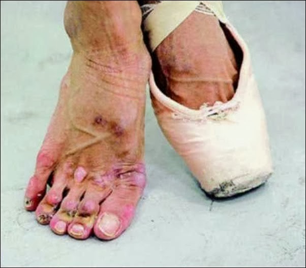 Sonhar Com Pé Machucado De Outra Pessoa Como são os pés das bailarinas ~ Humorados Face