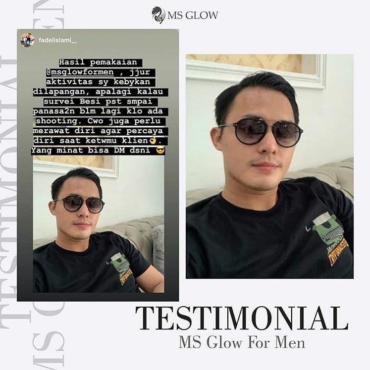 testimoni ms glow skin care