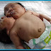 TWO HEAD BABY BORN IN CHINA
