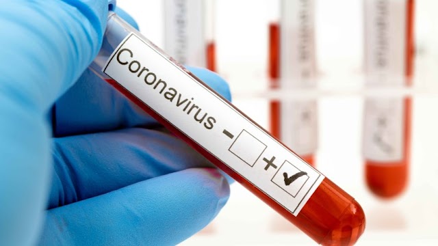 MSP dice siguen en descenso casos de coronavirus en el país