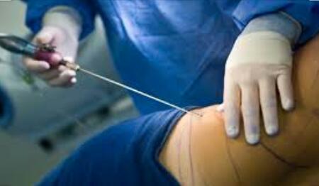 كيف تتم هذه العملية؟