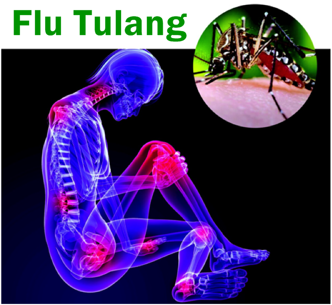 Obat Herbal Flu Tulang di Apotik - QnC Jelly Gamat Asli