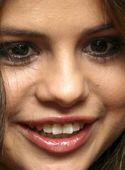 The 411 Dirt Did You Know Selena Gomez Has VENEERS?! *2019*