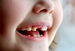 88 Arti Mimpi Gigi Depan Atas Copot Menurut Islam, Hindu Dan Primbon -  Pertanda Mimpi Gigi