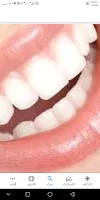 طريقه تبيض الاسنان,وصفات لتنظيف الاسنان,الاسنان