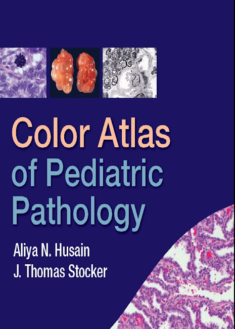 Color Atlas of Pediatric Pathology