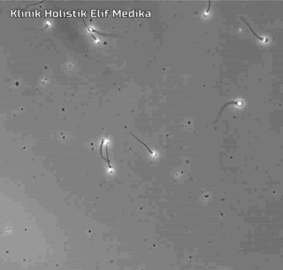 Motilitas Sperma : Progresive - Non Progresive - Immotaile Motilitas Sperma : Progresive - Non Progresive - Immotaile