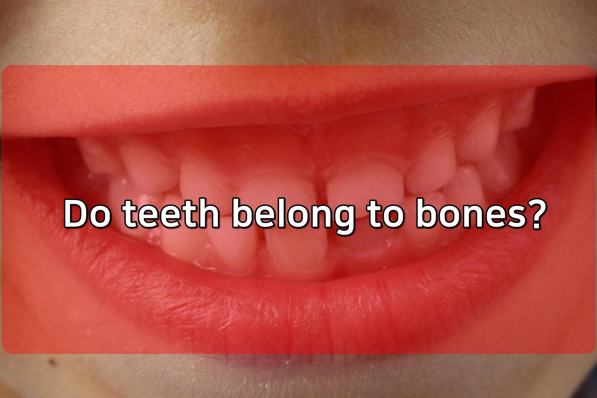 Do teeth belong to bones? RKIn