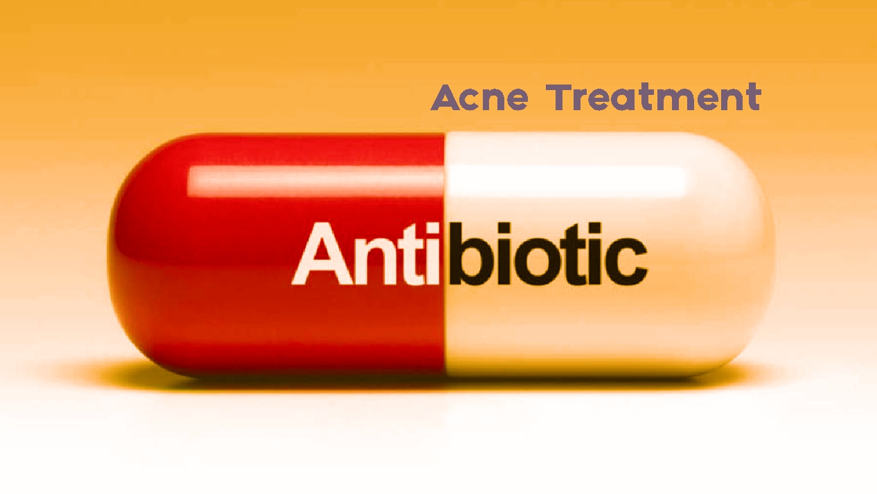 Acne Treatment Antibiotics