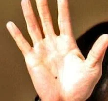 Mole On Left/Right Palm - Mole (Til) on Male/Female Hand ~ INDIAN