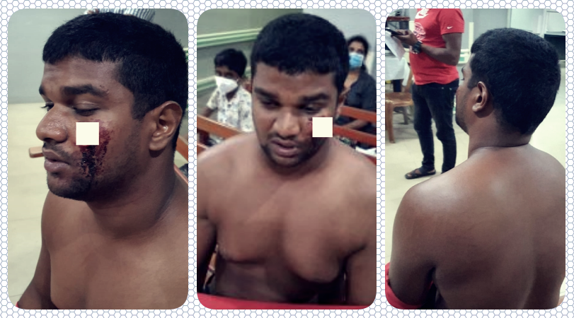 migara-gunaratne-incident migara-gunaratne-incident