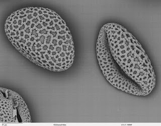 Lilium auratum (Doğu zambağı) polenlerinin Elektron mikroskopu altındaki görüntüsü