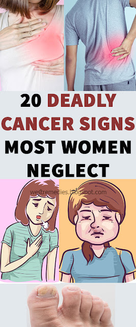 20 Deadly Cancer Signs Most Women Neglect