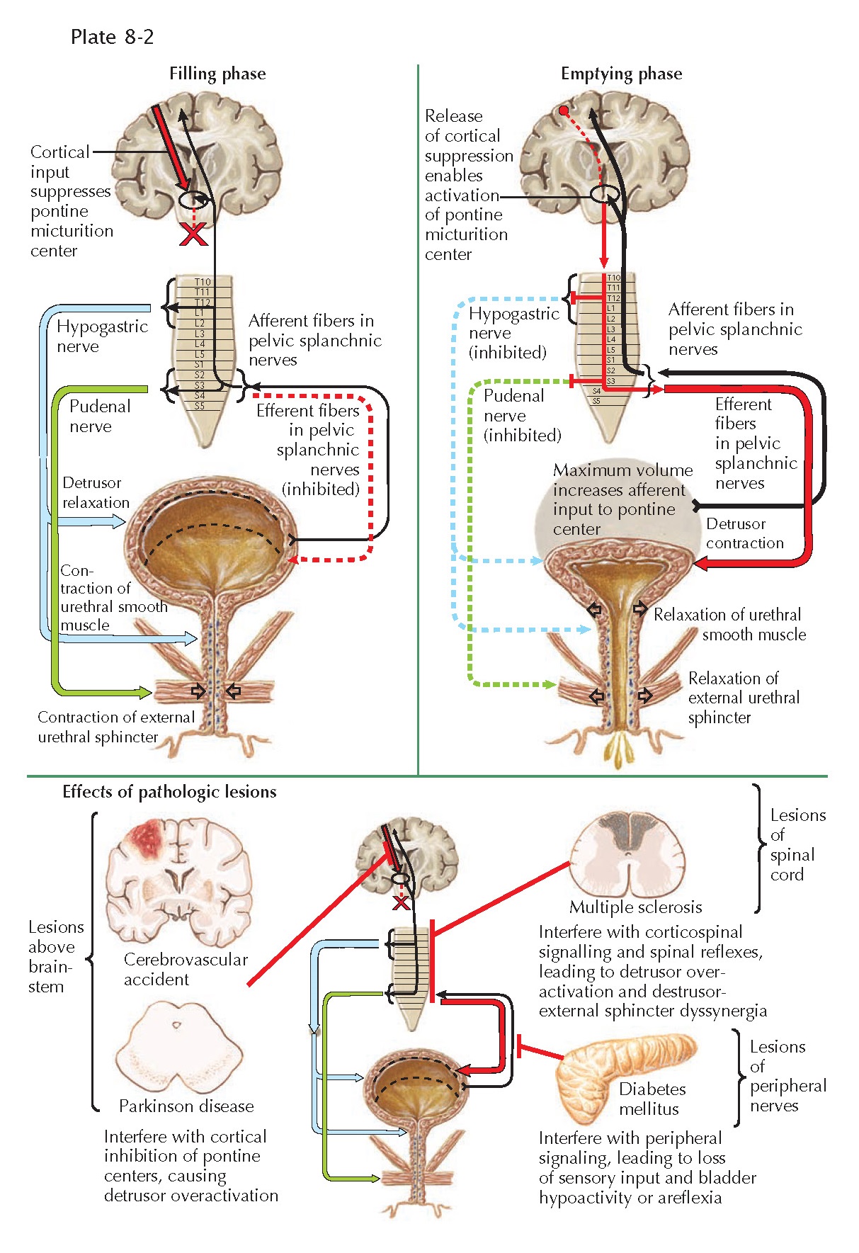 VOIDING DYSFUNCTION pediagenosis