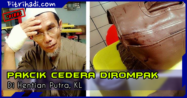 (Kisah) Seorang Pakcik Cedera Dirompak Di Hentian Putra, KL