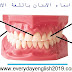 مفردات اسماء الاسنان بالانجليزي و العربي حصريا لاتفوتها مفردات اسماء الاسنان بالانجليزي و العربي حصريا لاتفوتها
