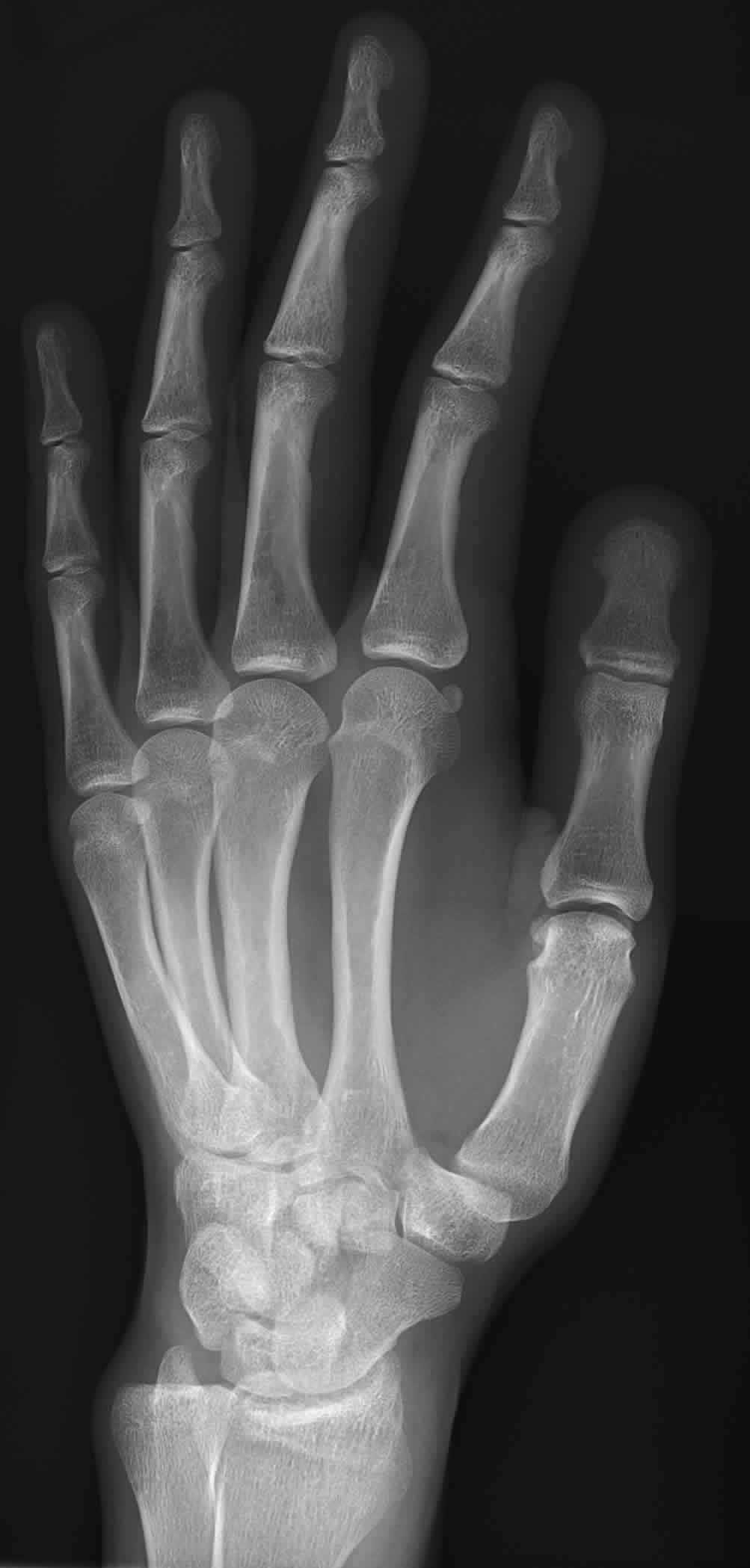 ¿Qué Son Los Rayos X?