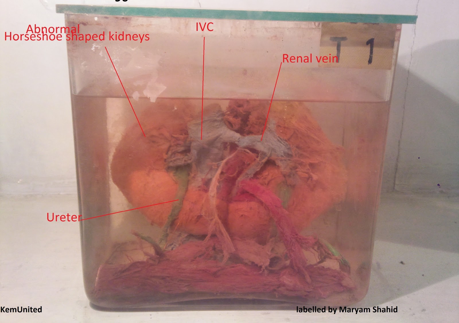 Abdomen & Pelvis Anatomy Spots Labelled