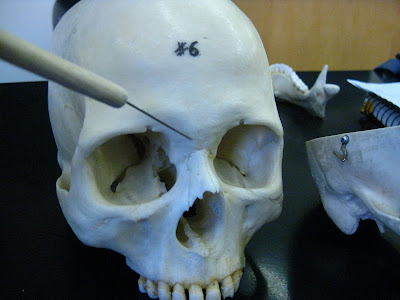 Boned: Human Skull - ethmoid bone (calvarial bone #8)