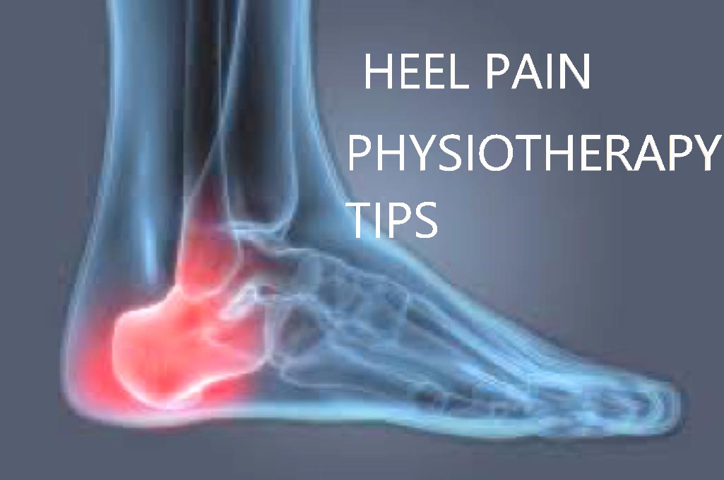 HEEL PAIN PLANTAR FASCITIIS PHYSIOTHERAPAY