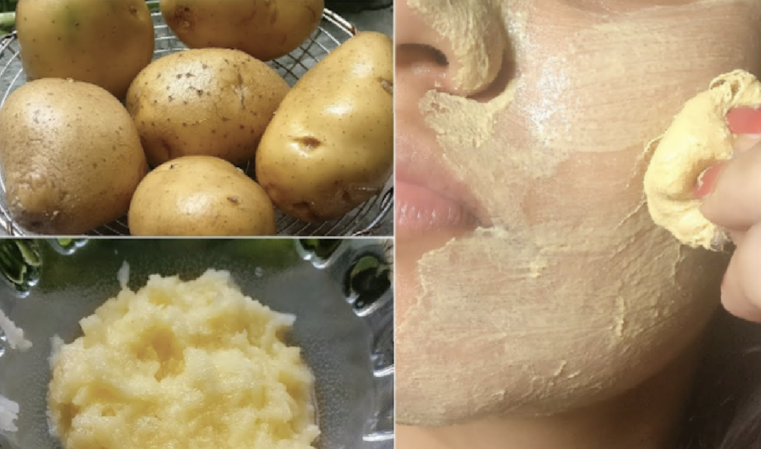 3 Easy Ways To Get Rid Dark Spots, Hyper Pigmentation and Rough Skin