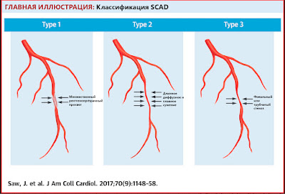Блог по клинической электрофизиологии: октября 2019