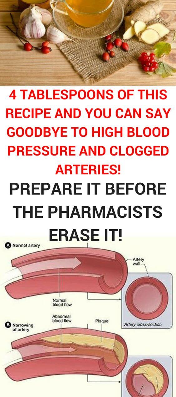 Prepare It Before The Pharmacists Erase It! 4 Tablespoons of This and