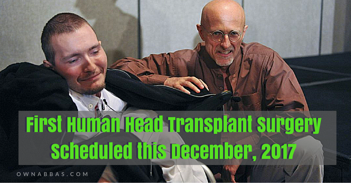 First Human Head Transplant Scheduled This December 2017 Own Abbas