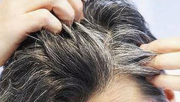 What if the hair is gray prematurely