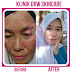 Paket Flek Hitam Drw skincare