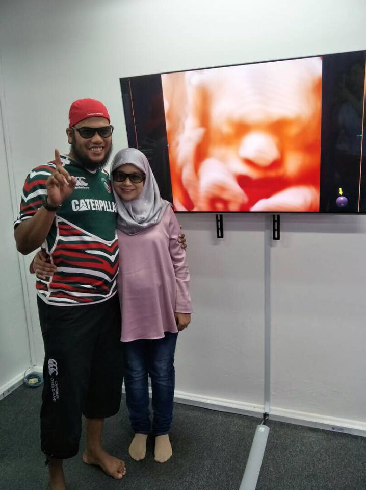 5D 6D SCAN SONOVISION