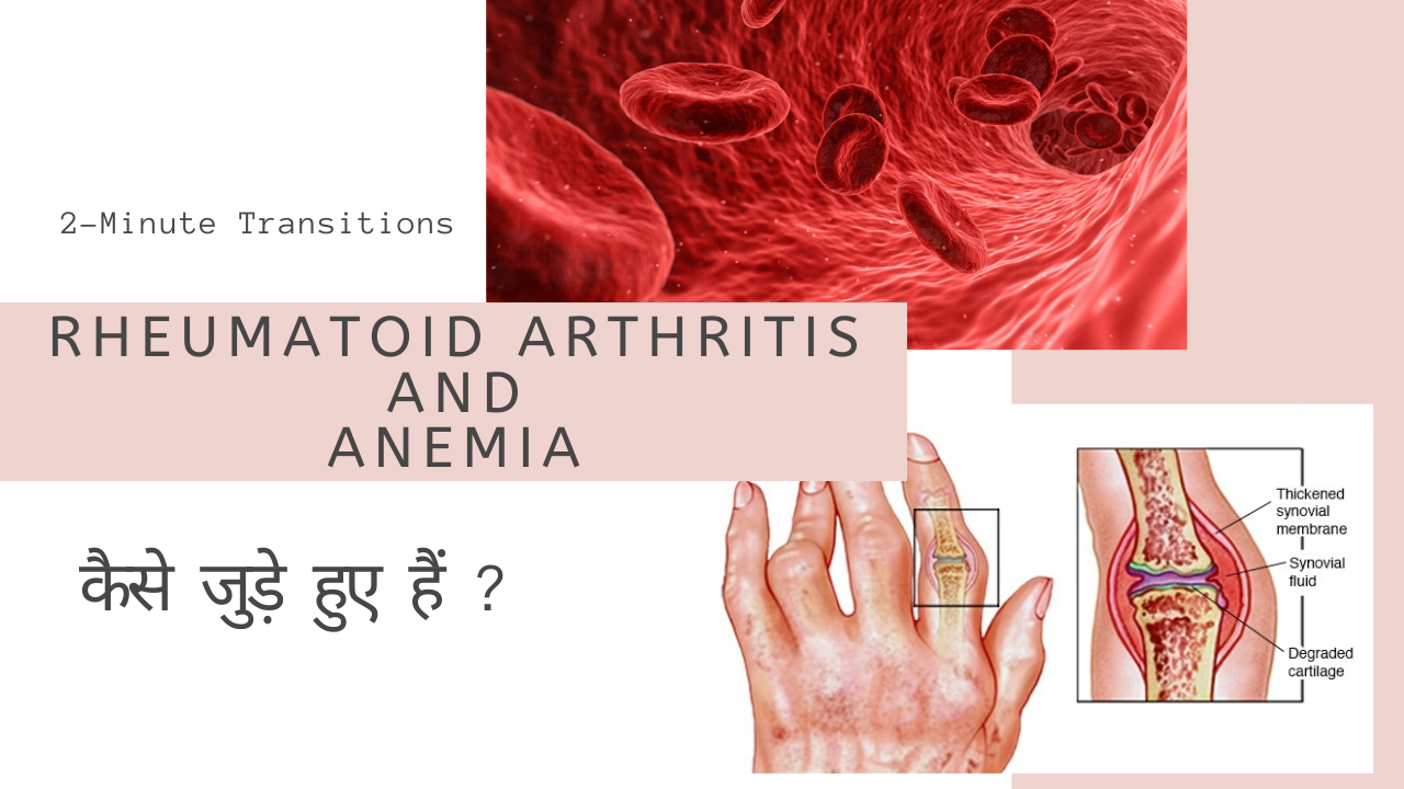 Rheumatoid Arthritis and Anemia जुड़े हुए हैं?